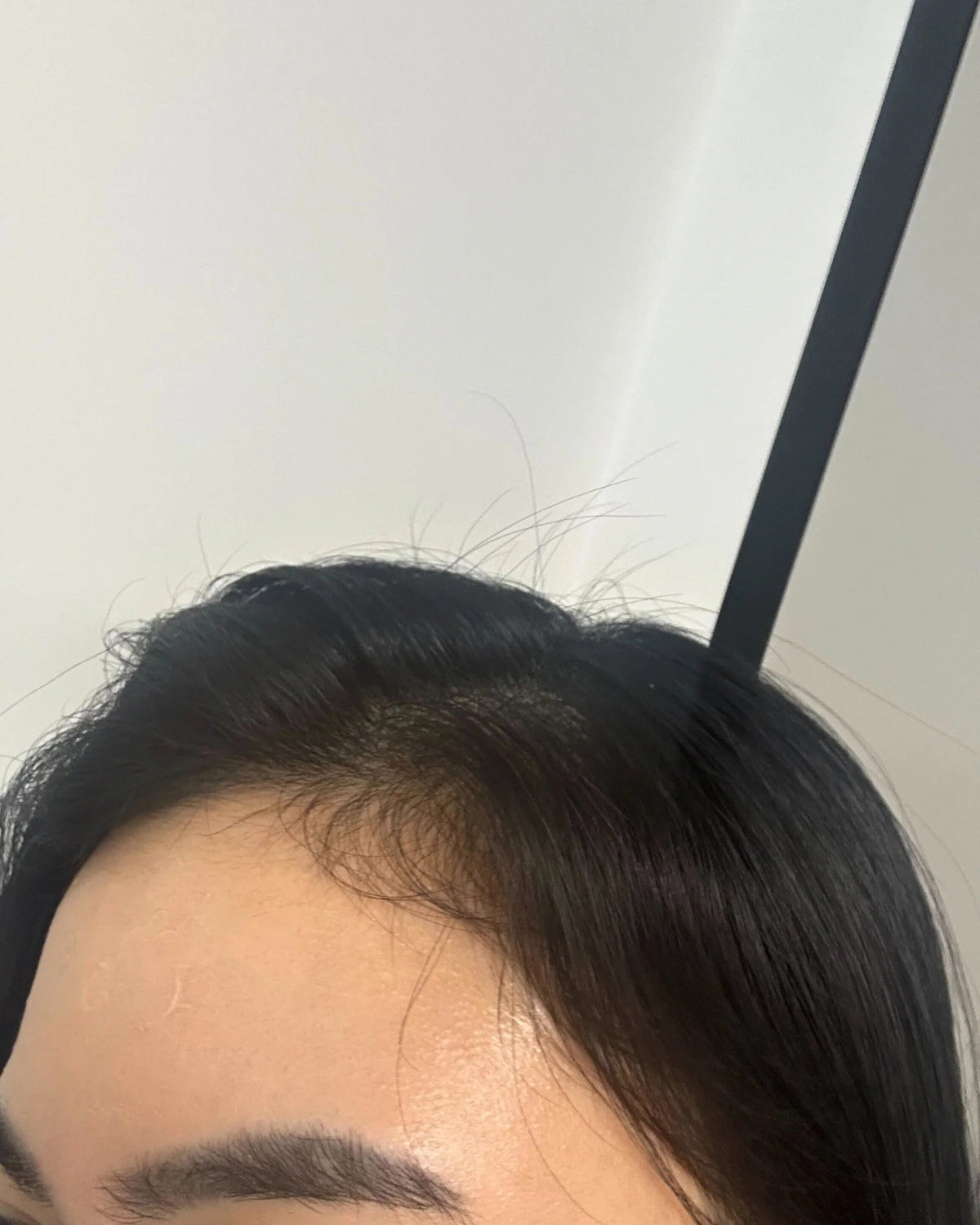 Rebirth Hair Growth System