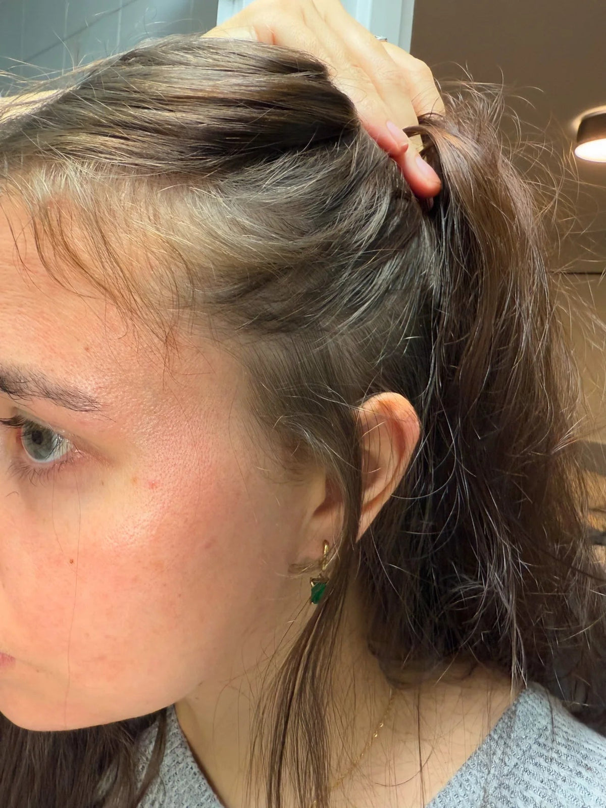 Rebirth Hair Growth System