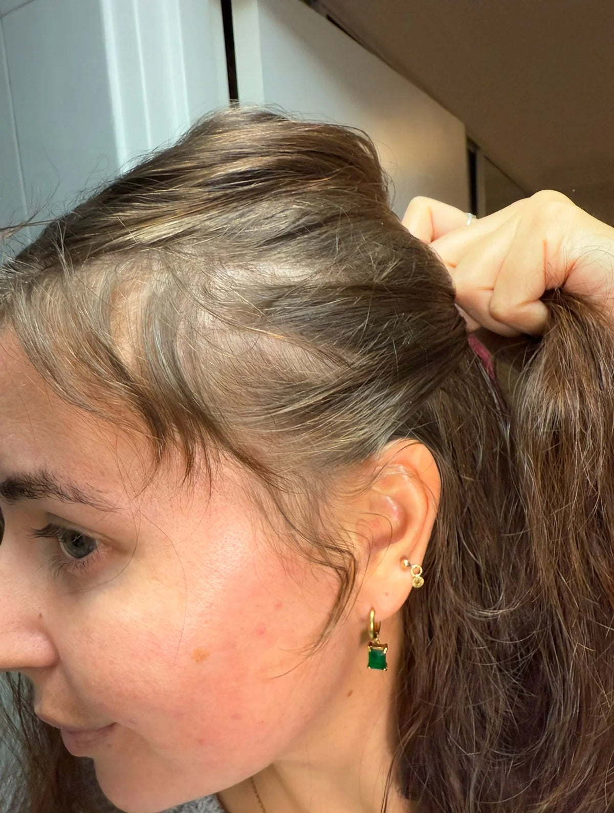 Rebirth Hair Growth System