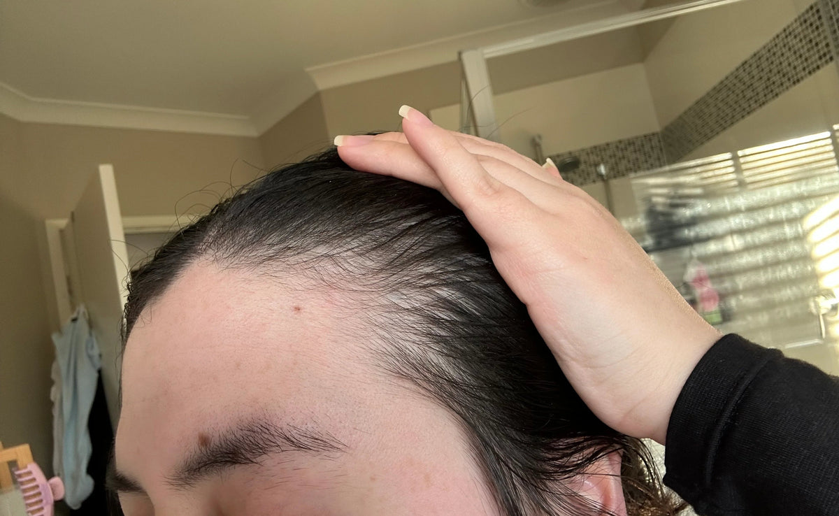 Rebirth Hair Growth System
