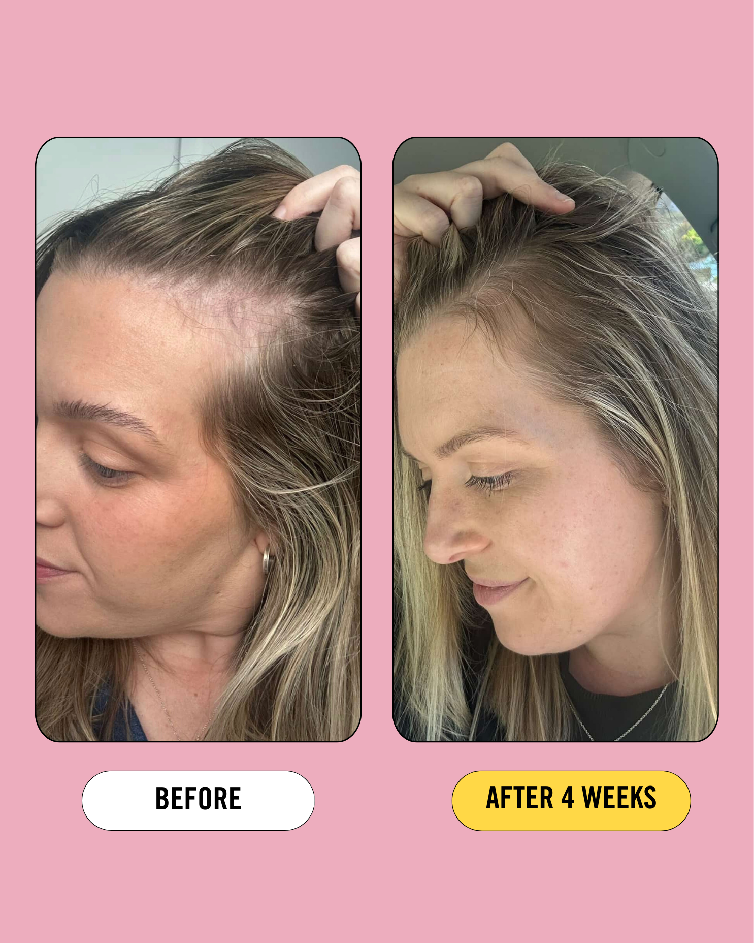 Post Pregnancy Hair Strength Support Supplement