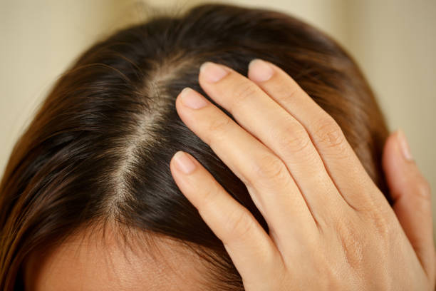 Scalp Exfoliation: Why It Matters for Hair Growth (and How to Do It)