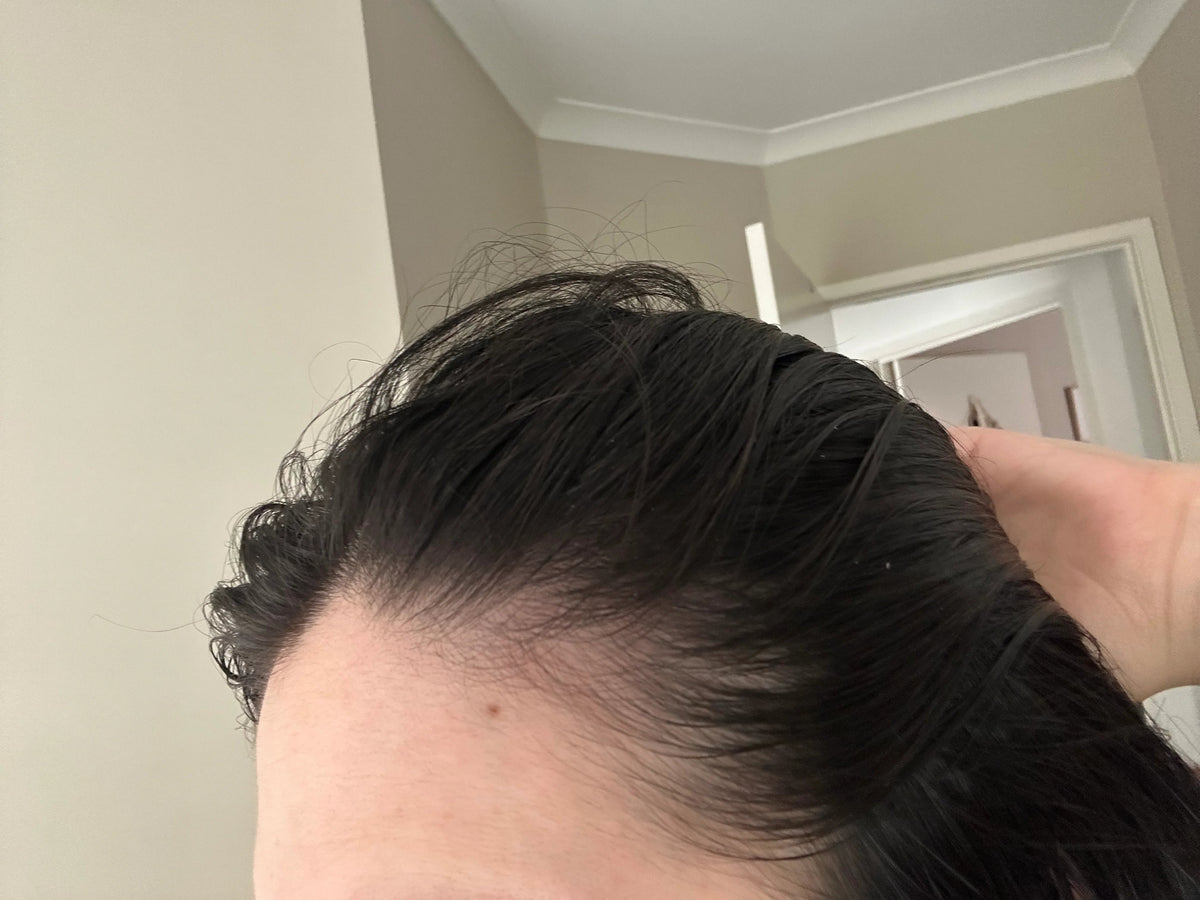 Rebirth Hair Growth System
