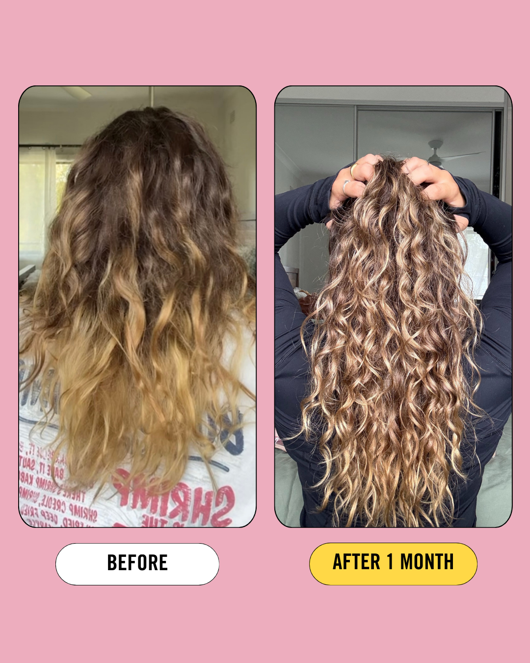 Post Pregnancy Support Kit