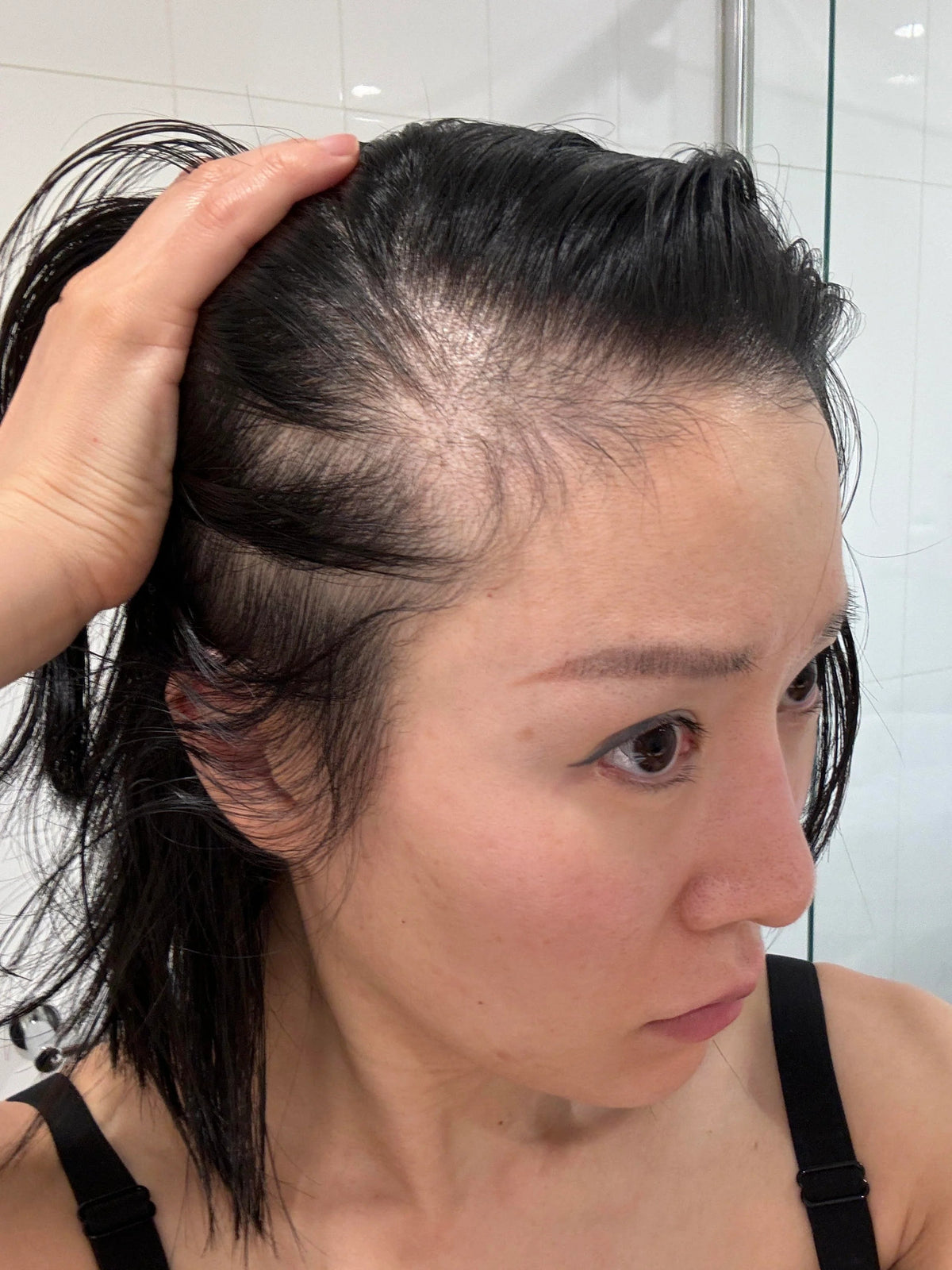 Rebirth Hair Growth System