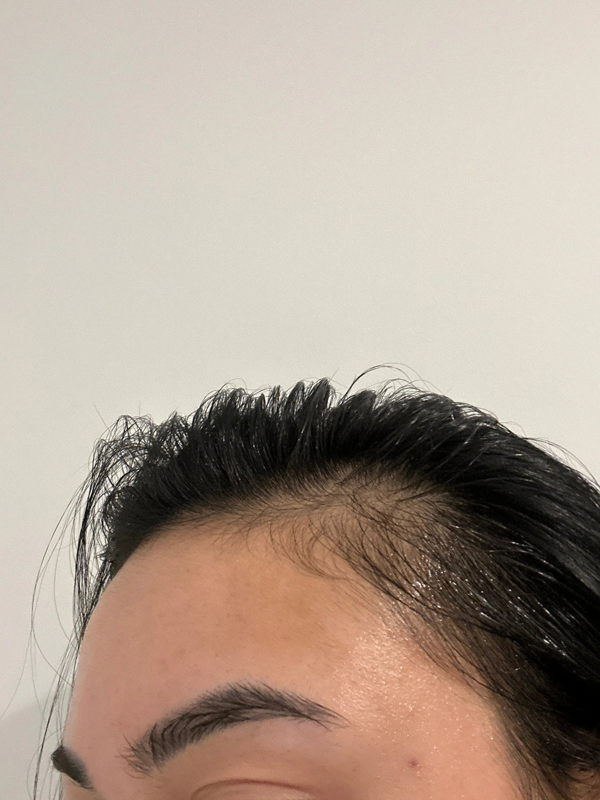 Rebirth Hair Growth System