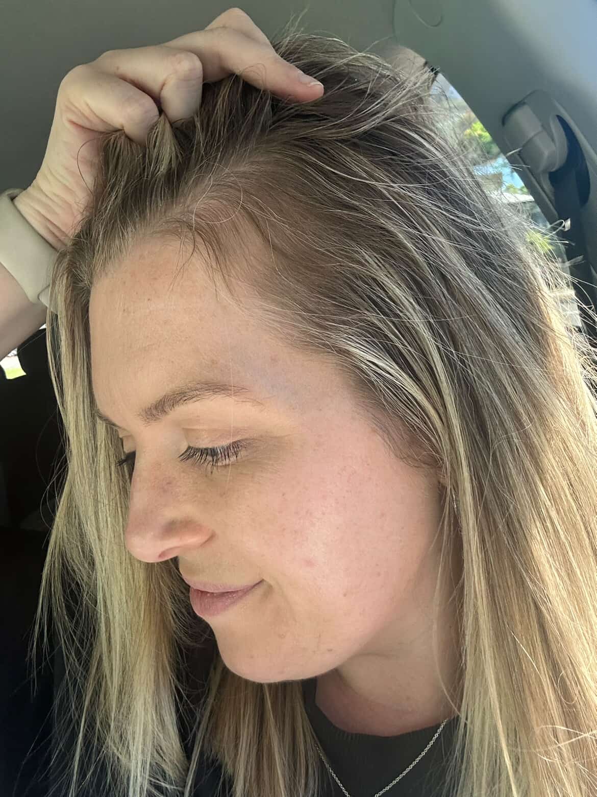 Rebirth Hair Growth System
